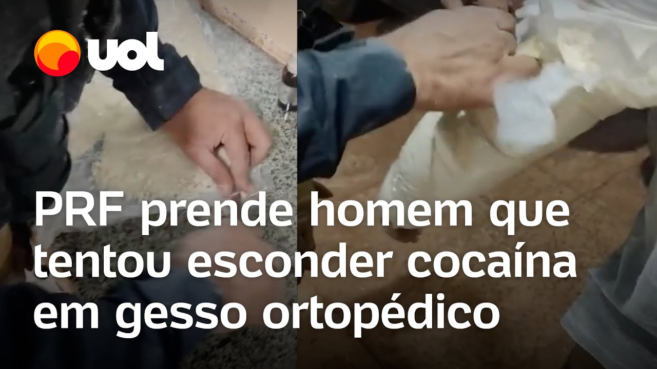 PRF prende traficante que tentou esconder cocaína em gesso ortopédico; veja