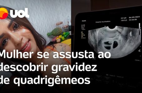 Mulher se assusta ao descobrir quadrigêmeos e médico brinca: ‘Os 4 bebês estão em festa’