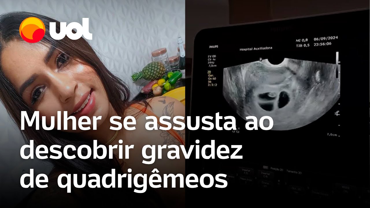 Mulher se assusta ao descobrir quadrigêmeos e médico brinca: ‘Os 4 bebês estão em festa’